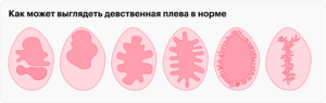 Гименопластика — наименее изученная операция на женских половых органов, но спрос на нее продолжает расти