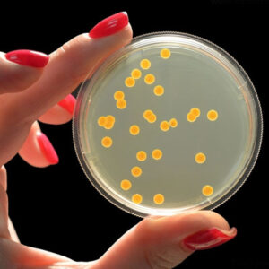 Золотистый стафилококк (S. aureus). Согласно информации с сайта сети медицинских лабораторий инвитро, он является самым распространенным и агрессивным видом бактерий. Вызывает более 60% от всех стафилококковых инфекций и может поражать любые органы.