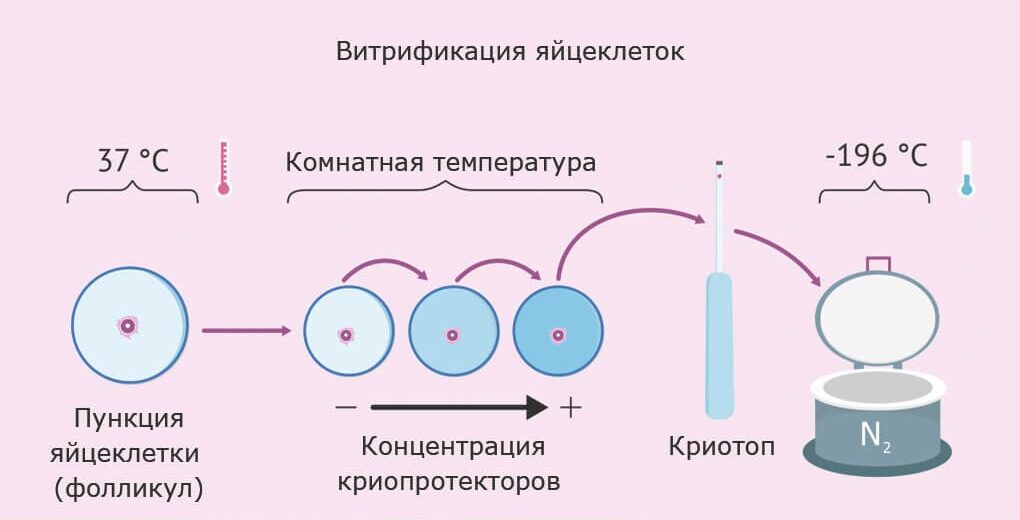 Витрификация яйцеклеток предполагает мгновенное снижение температуры до -196°С при использовании криопротекторов высокой концентрации